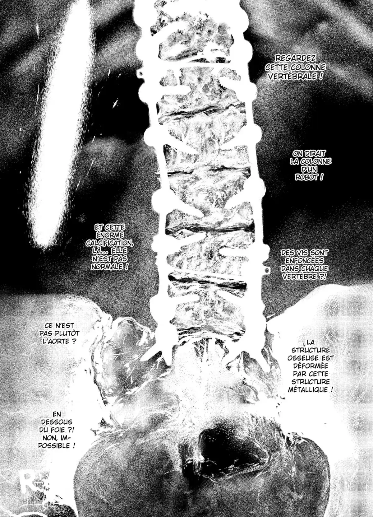 Young Black Jack Volume 4 page 18
