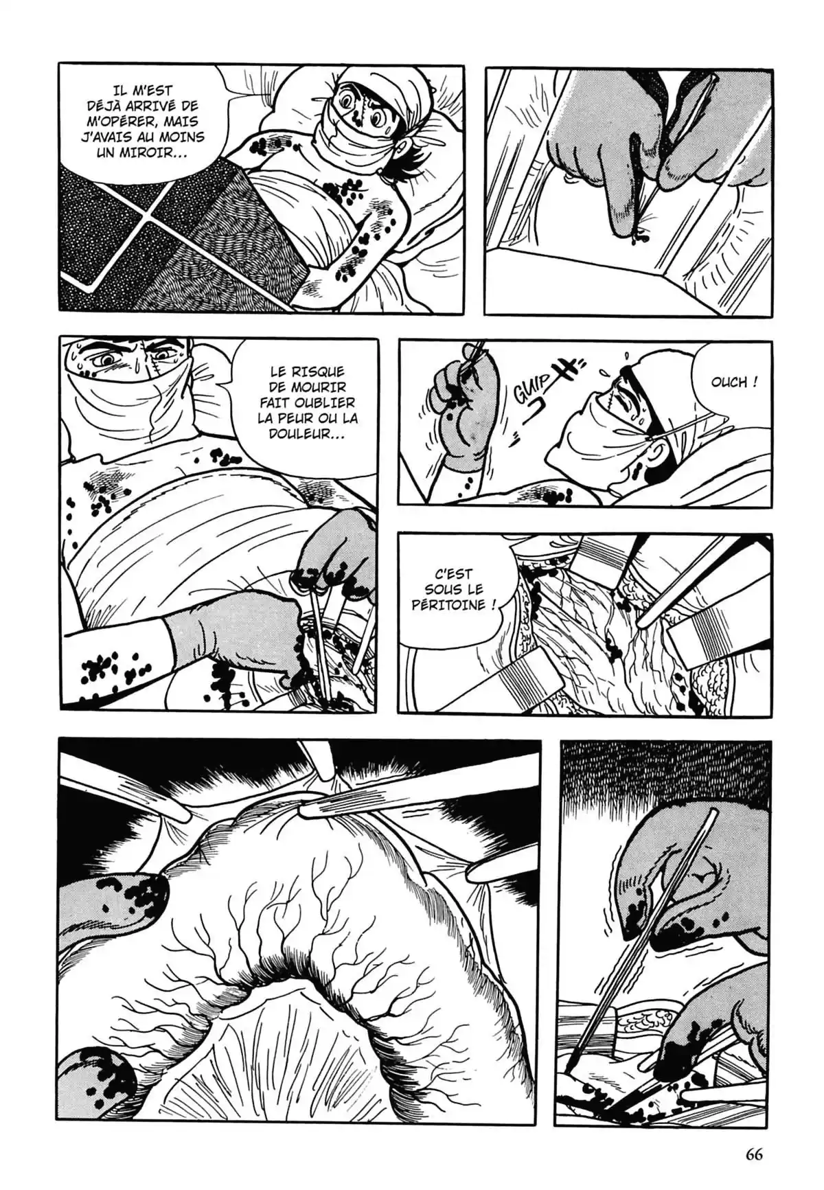 Black Jack Volume 3 page 65