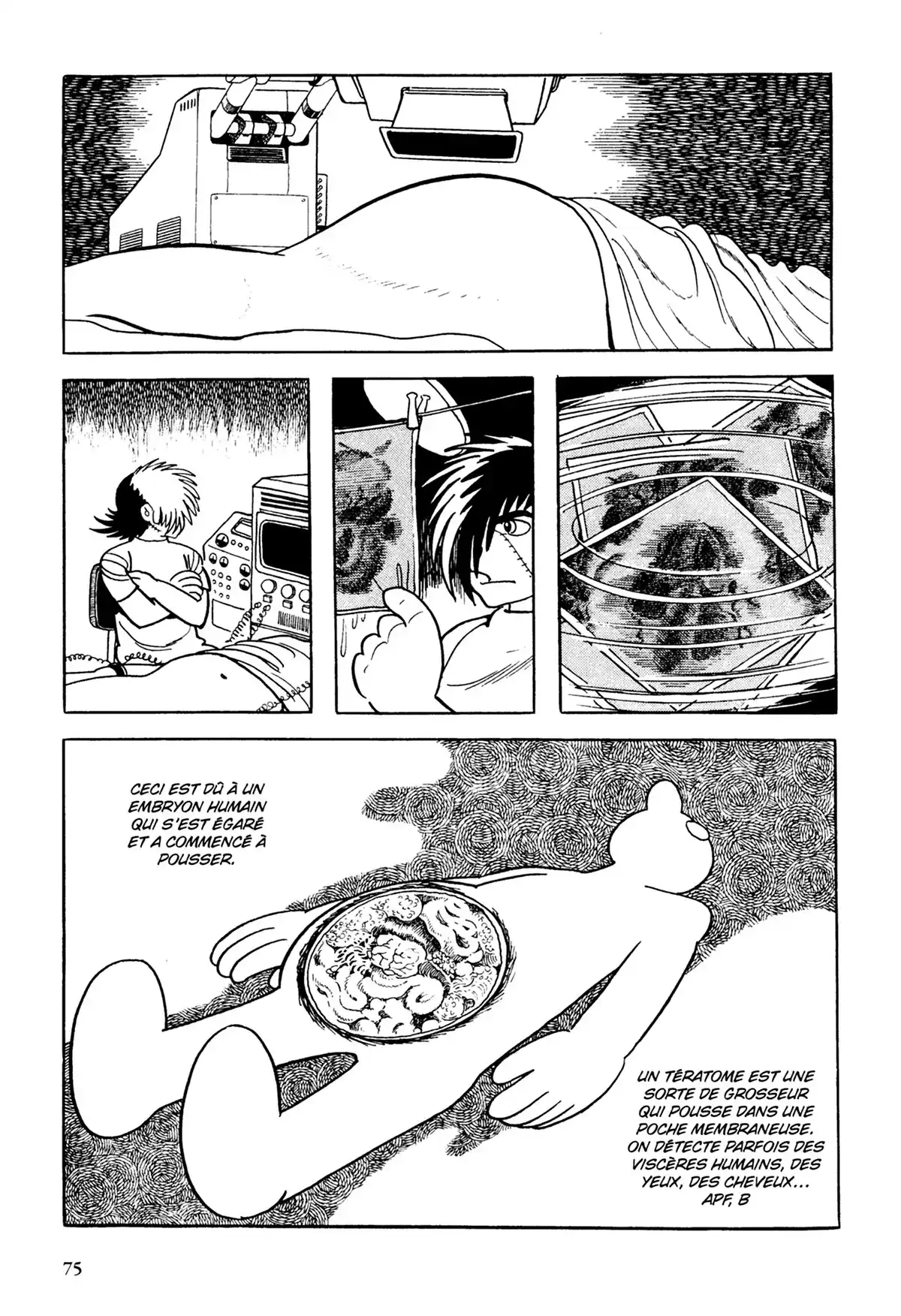 Black Jack Volume 13 page 76