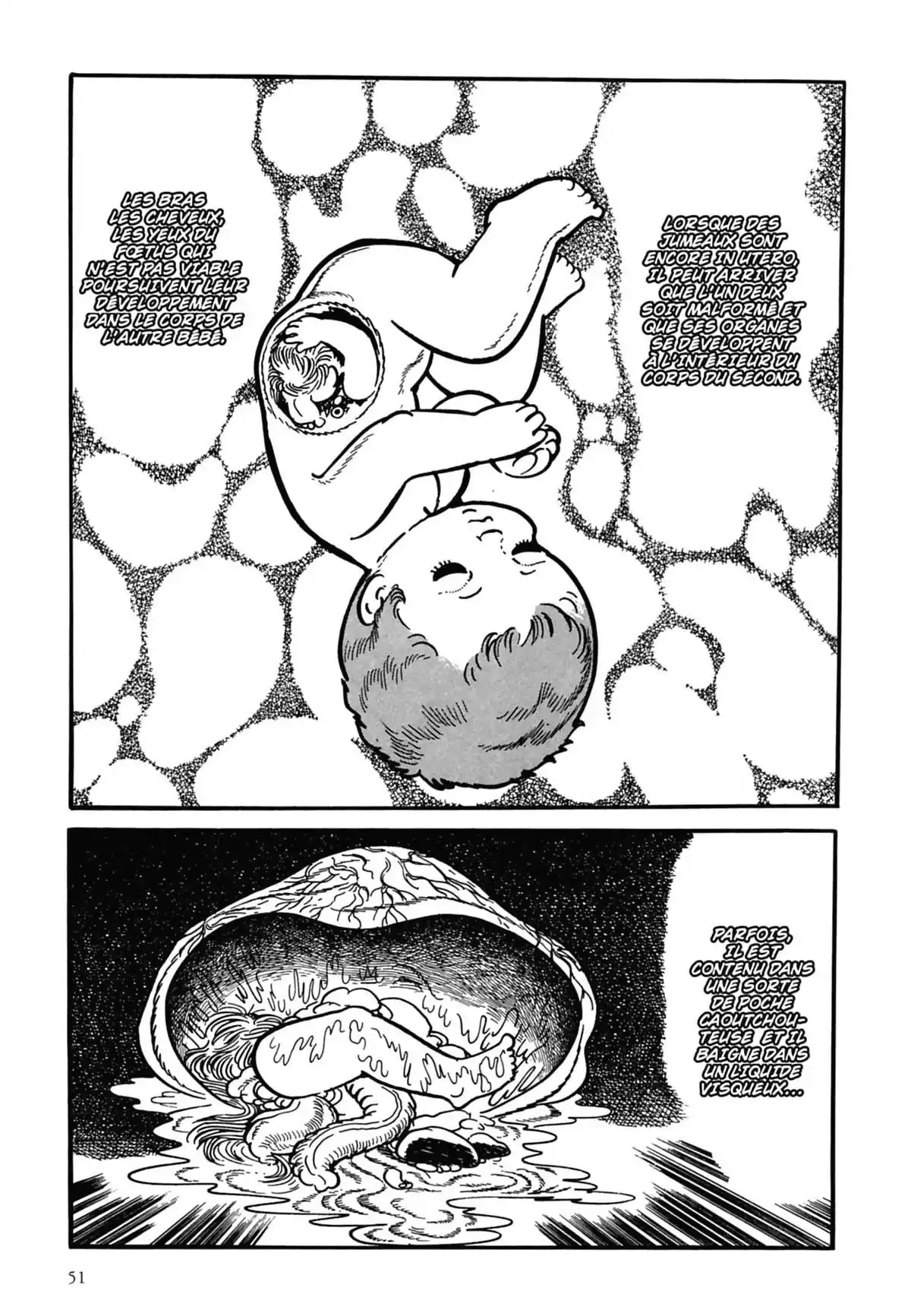 Black Jack Volume 1 page 52