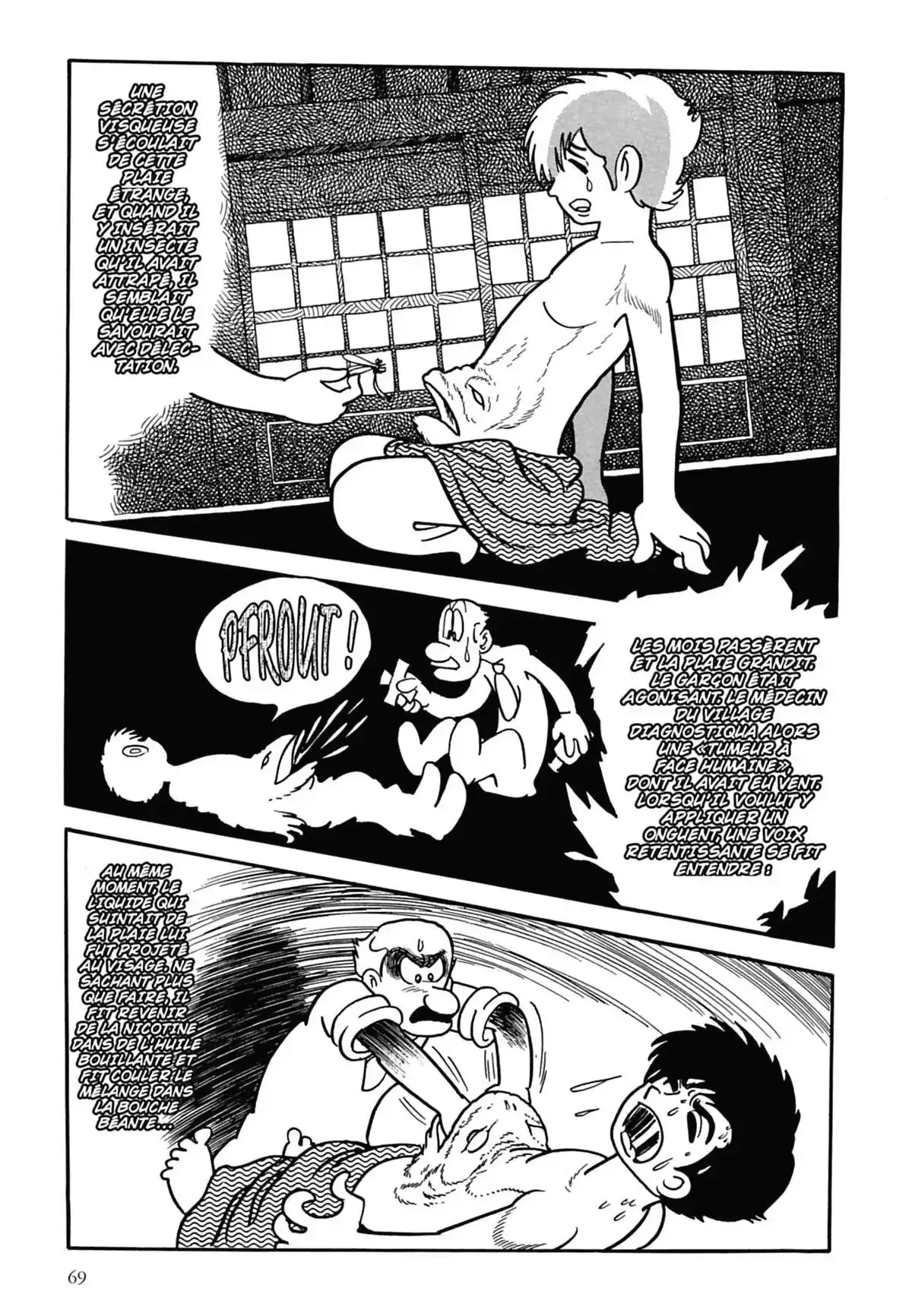 Black Jack Volume 1 page 70